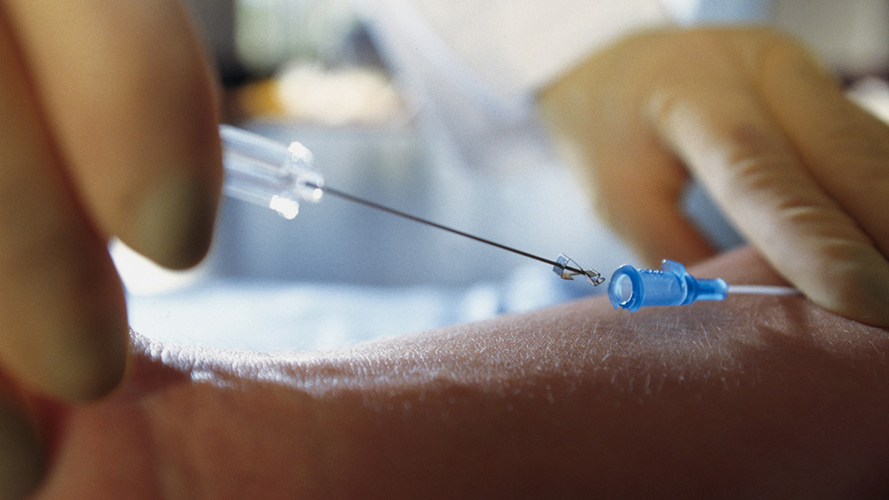 B. Braun 캐뉼라 주사기 클로즈업