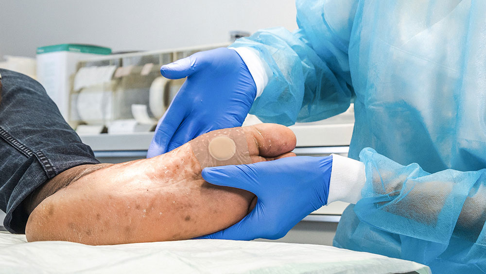 Two hands wearing gloves hold a diabetic foot with a plaster on it, in the background medical material in a medical room